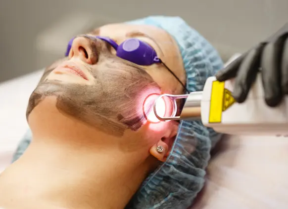 laser skincare treatment