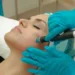 PRP Facial