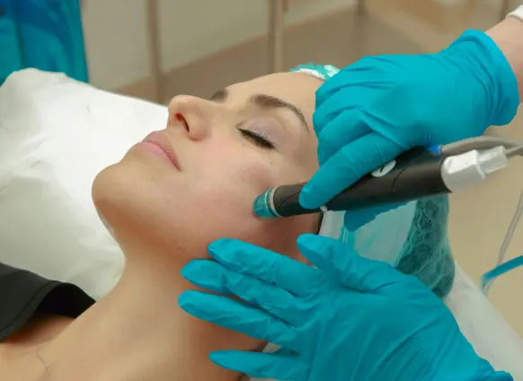 PRP Facial