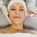 Fractora RF Microneedling