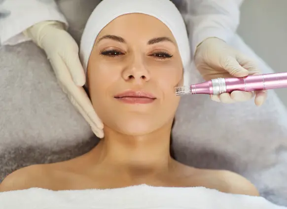 Fractora RF Microneedling