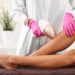 Laser Hair Removal Oakville