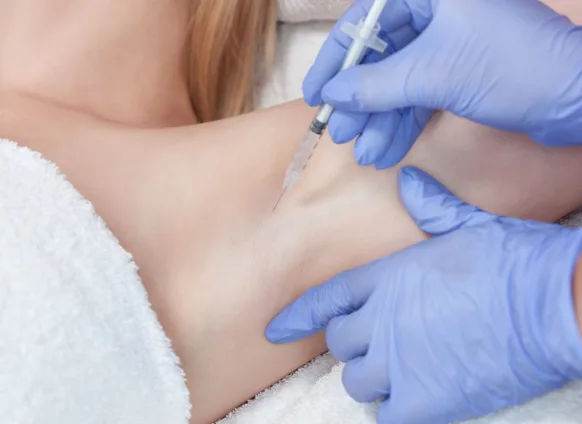 Hyperhidrosis Injections