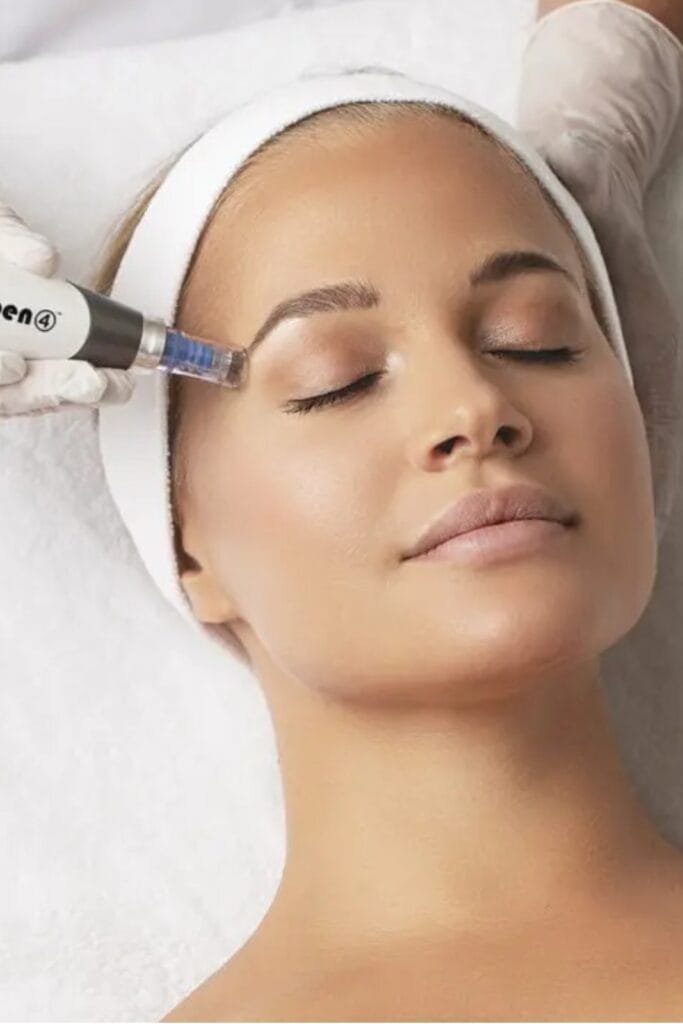 Microneedling Treatment